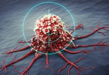 Създадоха „бактерия камикадзе“, която унищожава тумори тумори