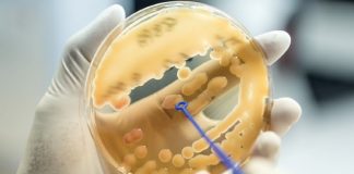 Клебсиела пневмония