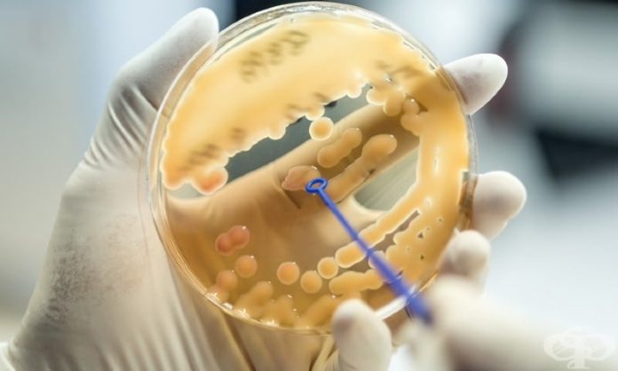 Клебсиела пневмония