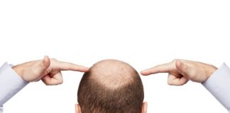 мъжката плешивост