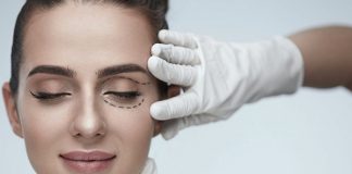 блефаропластика