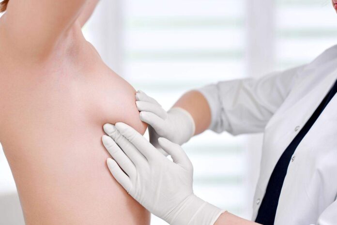 рак на гърдата