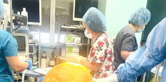 В „Александровска“‘ отстраниха 27-килограмов тумор от корема на жена тумор